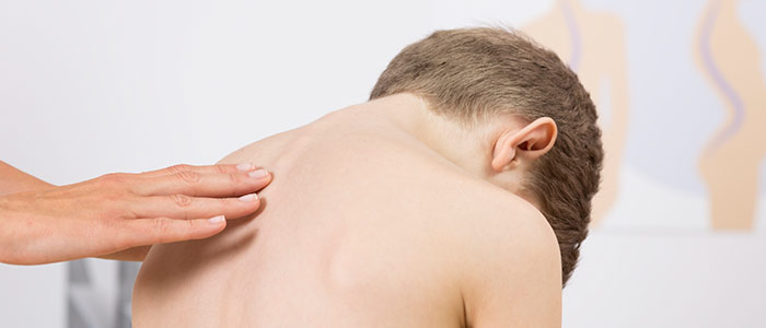 Chiropractic Care for Scoliosis